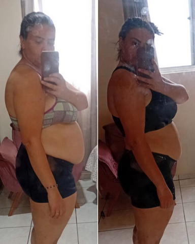 Antes e Depois do Dermodiet
