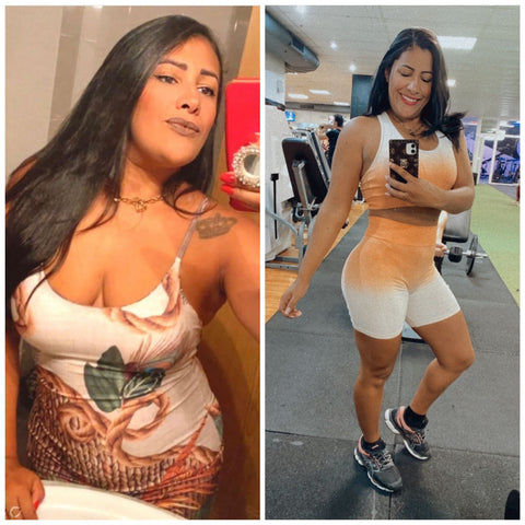 Antes e Depois do Dermodiet